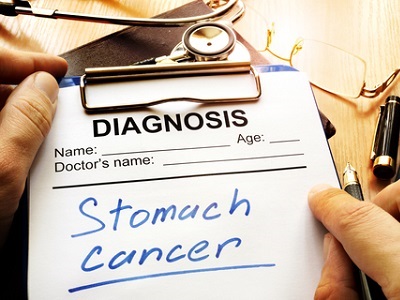  New Meds, More Reimbursements, Boosting Stomach Cancer Market